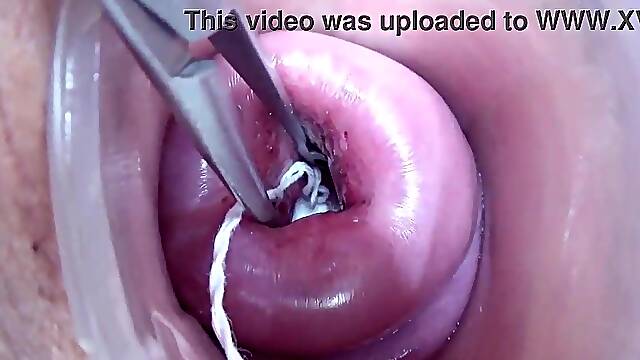 Lesbian babes pissing into the cervix of the other one directly since her pee gap